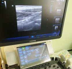Белгородская областная детская клиническая больница получила новый аппарат УЗИ экспертного класса